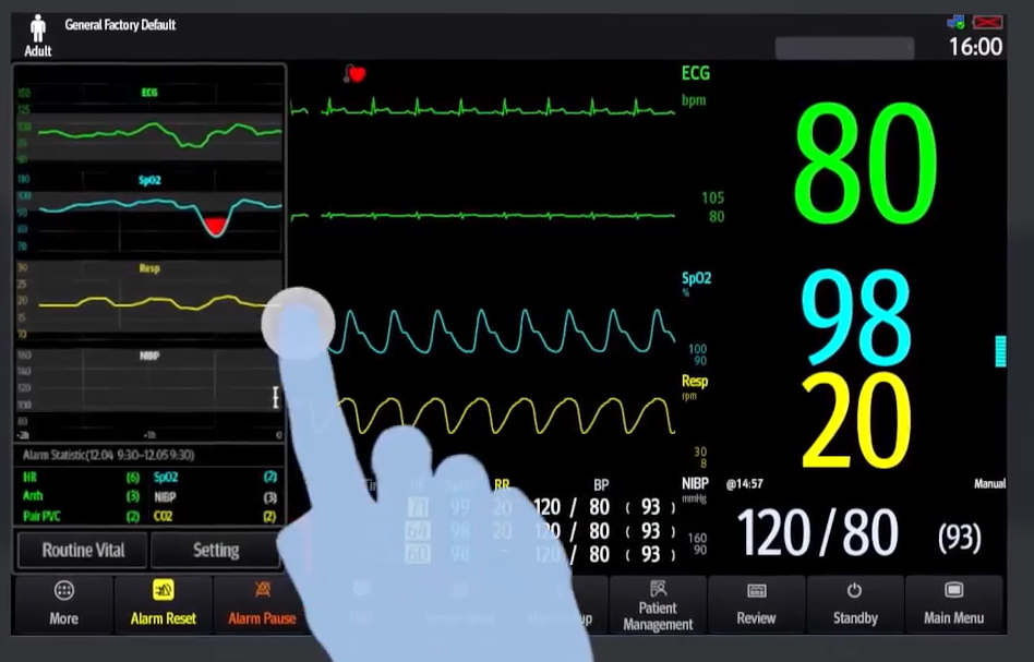 MONITOR multiparameter(Mindray ePM10) ward+acc.230V 50-60Hz