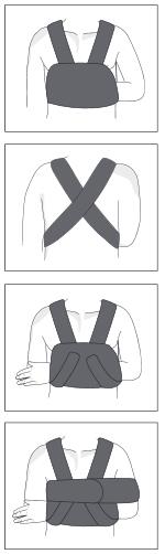 ATELLE D'EPAULE, taille M