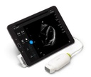 HAND-HELD ULTRASOUND (Lumify) + probe S4-1