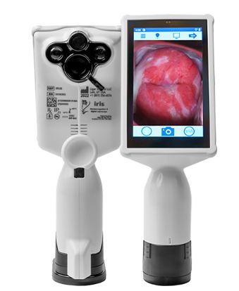 COLPOSCOPE, digitale, EVA Pro